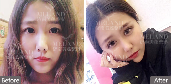 济南美莲整形医院怎么样啊